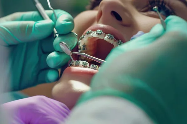 Orthodontic Treatment