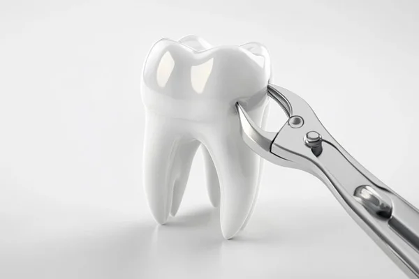 Tooth Extraction